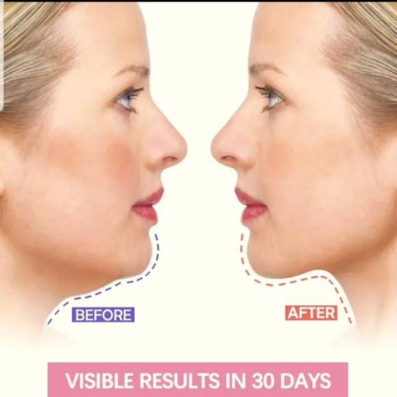 Face lifting mask - Picture 2 of 7